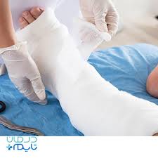خرید باند گچی ارتو پدی کاوه + فروش استثنایی